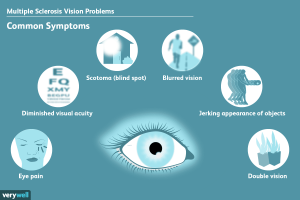 The most common vision problems related to stroke/نوید سلامت