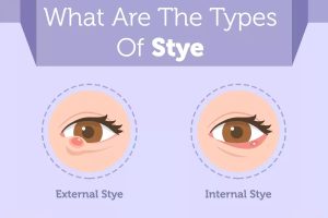 Types of eyelashes/نوید سلامت