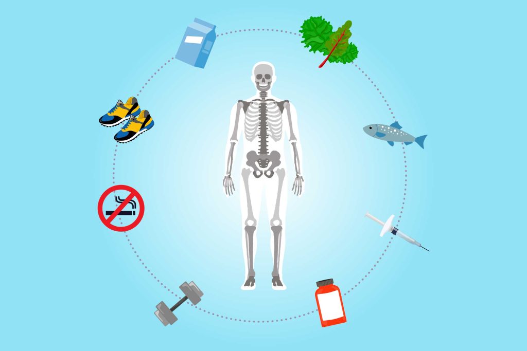 Prevention of osteoporosis/نوید سلامت