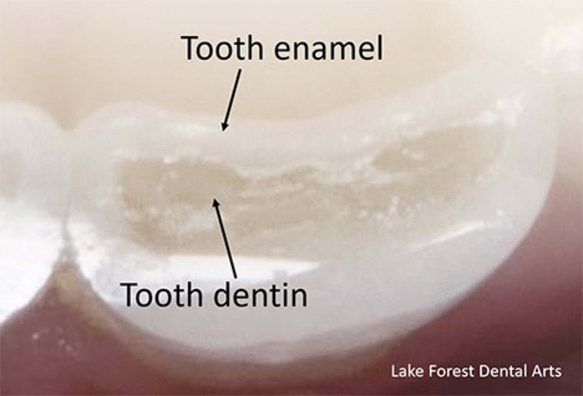 tooth-enamel/نوید سلامت