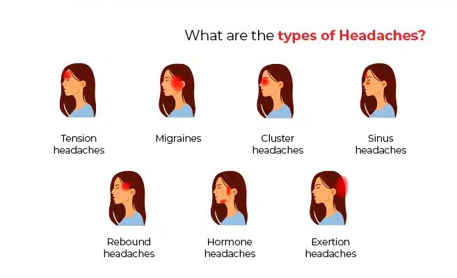 Types of migraine/نوید سلامت