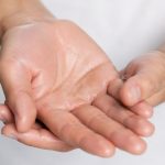 عرق کردن کف دست؛ آیا نشانه ضعف کبد است؟